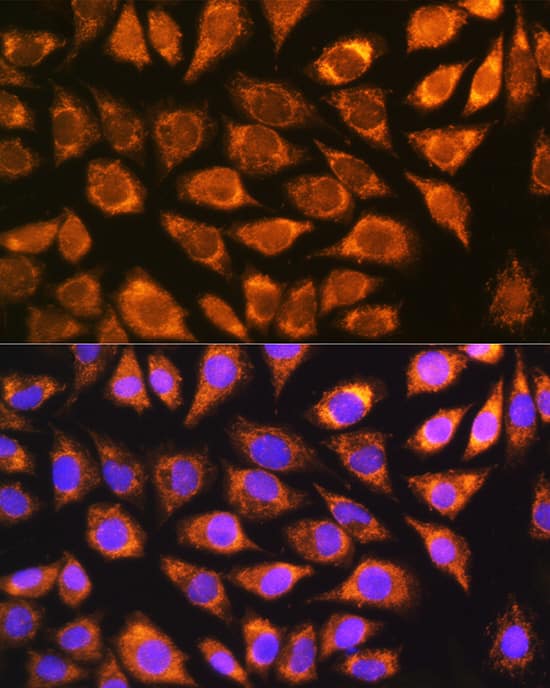 Immunocytochemistry/ Immunofluorescence: NDUFS5 Antibody [NBP3-37942] - Immunofluorescence analysis of L929 cells using NDUFS5 Rabbit pAb at dilution of 1:100 (40x lens). Secondary antibody: Cy3-conjugated Goat anti-Rabbit IgG (H+L) at 1:500 dilution. Blue: DAPI for nuclear staining.