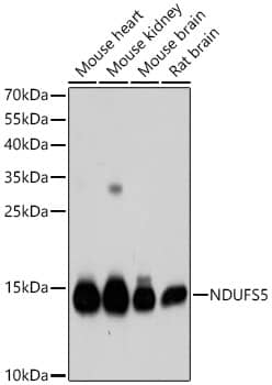 Western Blot: NDUFS5 Antibody [NBP3-37942] - Western blot analysis of various lysates, using [KD Validated] NDUFS5 Rabbit pAb at 1:1000 dilution.Secondary antibody: HRP-conjugated Goat anti-Rabbit IgG (H+L) at 1:10000 dilution.Lysates/proteins: 25ug per lane.Blocking buffer: 3% nonfat dry milk in TBST.Detection: ECL Basic Kit.Exposure time: 1s.