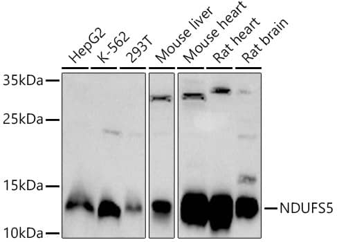 Western Blot: NDUFS5 Antibody [NBP3-37943] - Western blot analysis of various lysates using NDUFS5 Rabbit pAb at 1:1000 dilution.Secondary antibody: HRP-conjugated Goat anti-Rabbit IgG (H+L) at 1:10000 dilution.Lysates/proteins: 25ug per lane.Blocking buffer: 3% nonfat dry milk in TBST.Detection: ECL Basic Kit.Exposure time: 90s.