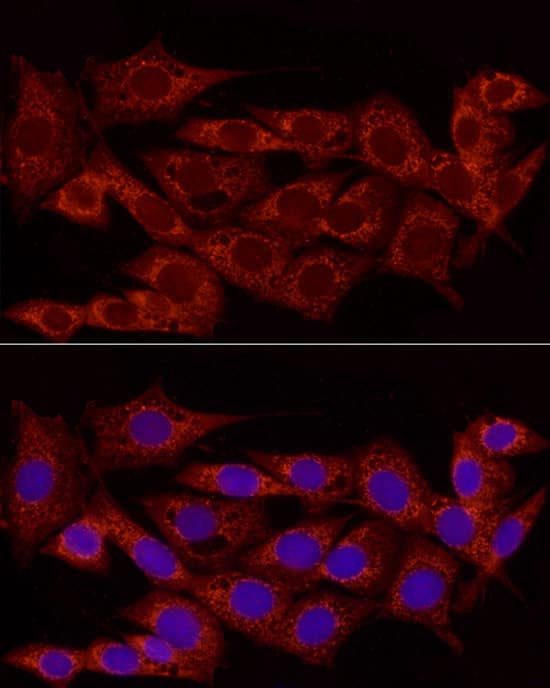 Immunocytochemistry/ Immunofluorescence: NDUFS5 Antibody [NBP3-37943] - Immunofluorescence analysis of NIH/3T3 cells using NDUFS5 Rabbit pAb at dilution of 1:100 (40x lens). Secondary antibody: Cy3-conjugated Goat anti-Rabbit IgG (H+L) at 1:500 dilution. Blue: DAPI for nuclear staining.