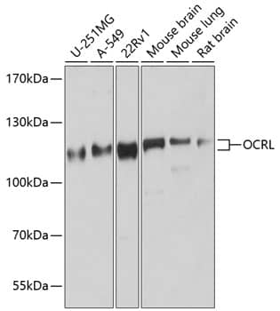 Western Blot: OCRL Antibody [NBP3-37944] - Western blot analysis of various lysates using OCRL Rabbit pAb at 1:1000 dilution.Secondary antibody: HRP-conjugated Goat anti-Rabbit IgG (H+L) at 1:10000 dilution.Lysates/proteins: 25ug per lane.Blocking buffer: 3% nonfat dry milk in TBST.Detection: ECL Basic Kit.Exposure time: 30s.