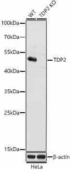 Western Blot: ETS1 associated protein II Antibody [NBP3-37946] - Western Blot analysis of lysates from wild type(WT) and ETS1 associated protein II knockout (KO) HeLa(KO) cells, using [KO Validated] ETS1 associated protein II Rabbit pAb at 1:3000 dilution.Secondary antibody: HRP-conjugated Goat anti-Rabbit IgG (H+L) at 1:10000 dilution.Lysates/proteins: 25ug per lane.Blocking buffer: 3% nonfat dry milk in TBST.Detection: ECL Basic Kit.Exposure time: 10s.