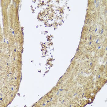 Immunohistochemistry: PIK3C2A Antibody [NBP3-37948] - Immunohistochemistry analysis of paraffin-embedded Mouse heart using PIK3C2A Rabbit pAb at dilution of 1:100 (40x lens). Microwave antigen retrieval performed with 0.01M PBS Buffer (pH 7.2) prior to IHC staining.