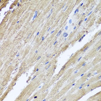 Immunohistochemistry: PIK3C2A Antibody [NBP3-37948] - Immunohistochemistry analysis of paraffin-embedded Rat heart using PIK3C2A Rabbit pAb at dilution of 1:100 (40x lens). Microwave antigen retrieval performed with 0.01M PBS Buffer (pH 7.2) prior to IHC staining.