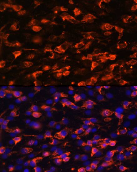 Immunocytochemistry/ Immunofluorescence: PIK3C2A Antibody [NBP3-37948] - Immunofluorescence analysis of C6 cells using PIK3C2A Rabbit pAb at dilution of 1:100. Secondary antibody: Cy3-conjugated Goat anti-Rabbit IgG (H+L) at 1:500 dilution. Blue: DAPI for nuclear staining.