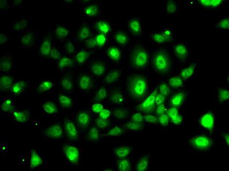 Immunocytochemistry/ Immunofluorescence: PPP2R1B Antibody [NBP3-37951] - Immunofluorescence analysis of MCF7 cells using [KO Validated] PPP2R1B Rabbit pAb.Secondary antibody: Cy3-conjugated Goat anti-Rabbit IgG (H+L) at 1:500 dilution.