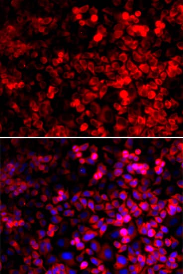 Immunocytochemistry/ Immunofluorescence: QARS Antibody [NBP3-37952] - Immunofluorescence analysis of U2OS cells using QARS Rabbit pAb. Secondary antibody: Cy3-conjugated Goat anti-Rabbit IgG (H+L) at 1:500 dilution. Blue: DAPI for nuclear staining.