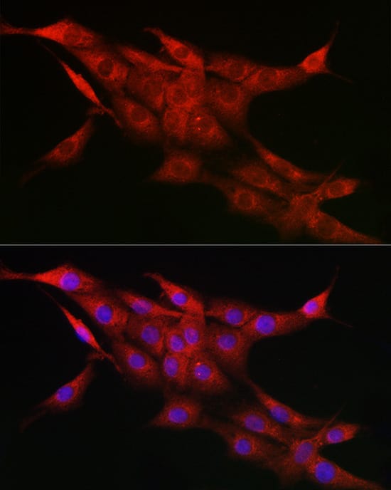 Immunocytochemistry/ Immunofluorescence: Cytochrome P450 1A1 Antibody [NBP3-37955] - Immunofluorescence analysis of PC-12 cells using Cytochrome P450 1A1 Rabbit pAb at dilution of 1:100 (40x lens). Secondary antibody: Cy3-conjugated Goat anti-Rabbit IgG (H+L) at 1:500 dilution. Blue: DAPI for nuclear staining.