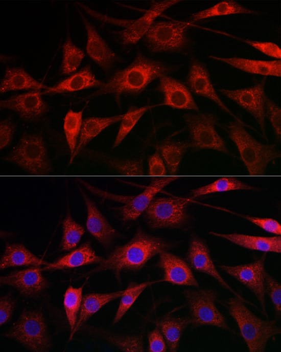 Immunocytochemistry/ Immunofluorescence: Cytochrome P450 1A1 Antibody [NBP3-37955] - Immunofluorescence analysis of NIH/3T3 cells using Cytochrome P450 1A1 Rabbit pAb at dilution of 1:100 (40x lens). Secondary antibody: Cy3-conjugated Goat anti-Rabbit IgG (H+L) at 1:500 dilution. Blue: DAPI for nuclear staining.