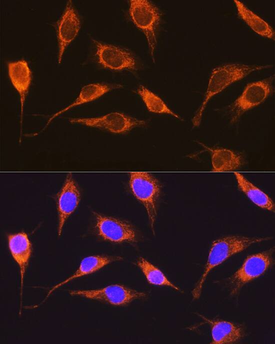 Immunocytochemistry/ Immunofluorescence: RCN1 Antibody [NBP3-37956] - Immunofluorescence analysis of L929 cells using RCN1 Rabbit pAb at dilution of 1:100 (40x lens). Secondary antibody: Cy3-conjugated Goat anti-Rabbit IgG (H+L) at 1:500 dilution. Blue: DAPI for nuclear staining.