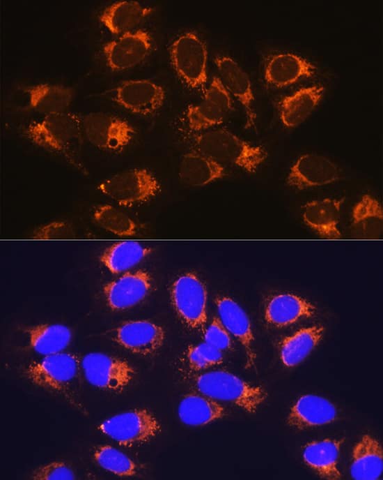 Immunocytochemistry/ Immunofluorescence: RCN1 Antibody [NBP3-37956] - Immunofluorescence analysis of U-2 OS cells using RCN1 Rabbit pAb at dilution of 1:100 (40x lens). Secondary antibody: Cy3-conjugated Goat anti-Rabbit IgG (H+L) at 1:500 dilution. Blue: DAPI for nuclear staining.