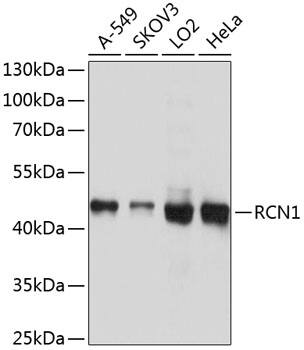 Western Blot: RCN1 Antibody [NBP3-37956] - Western blot analysis of various lysates using RCN1 Rabbit pAb at 1:1000 dilution.Secondary antibody: HRP-conjugated Goat anti-Rabbit IgG (H+L) at 1:10000 dilution.Lysates/proteins: 25ug per lane.Blocking buffer: 3% nonfat dry milk in TBST.Detection: ECL Basic Kit.Exposure time: 1s.