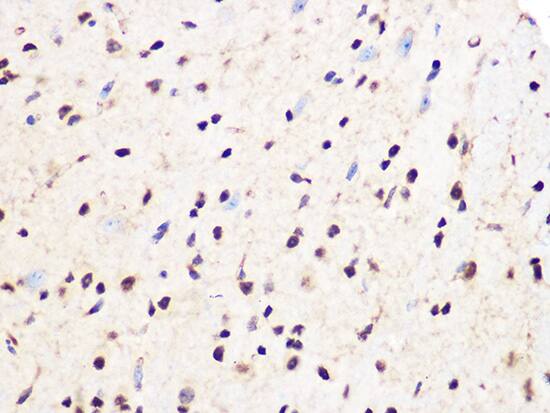 Immunohistochemistry: PCIF1 Antibody [NBP3-37957] - Immunohistochemistry analysis of paraffin-embedded Mouse spinal cord using PCIF1 Rabbit pAb at dilution of 1:100 (40x lens). Microwave antigen retrieval performed with 0.01M Tris/EDTA Buffer (pH 9.0) prior to IHC staining.
