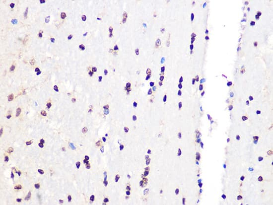 Immunohistochemistry: PCIF1 Antibody [NBP3-37957] - Immunohistochemistry analysis of paraffin-embedded Rat brain using PCIF1 Rabbit pAb at dilution of 1:100 (40x lens). Microwave antigen retrieval performed with 0.01M Tris/EDTA Buffer (pH 9.0) prior to IHC staining.