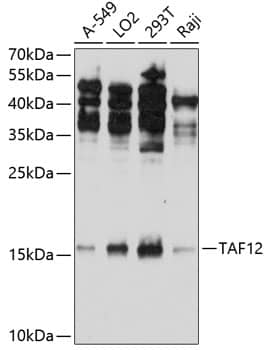 Western Blot: TAF12 Antibody [NBP3-37958] - Western blot analysis of various lysates using TAF12 Rabbit pAb at 1:1000 dilution.Secondary antibody: HRP-conjugated Goat anti-Rabbit IgG (H+L) at 1:10000 dilution.Lysates/proteins: 25ug per lane.Blocking buffer: 3% nonfat dry milk in TBST.Detection: ECL Enhanced Kit.Exposure time: 120s.