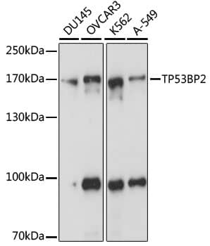 Western Blot: 53BP2 Antibody [NBP3-37959] - Western blot analysis of various lysates using 53BP2 Rabbit pAb at 1:1000 dilution.Secondary antibody: HRP-conjugated Goat anti-Rabbit IgG (H+L) at 1:10000 dilution.Lysates/proteins: 25ug per lane.Blocking buffer: 3% nonfat dry milk in TBST.Detection: ECL Basic Kit.Exposure time: 1s.