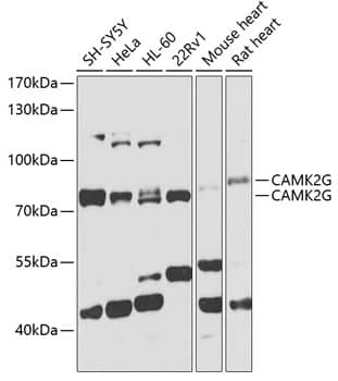 Western Blot: CaM Kinase II gamma Antibody [NBP3-37964] - Western blot analysis of various lysates using CaM Kinase II gamma Rabbit pAb at 1:1000 dilution.Secondary antibody: HRP-conjugated Goat anti-Rabbit IgG (H+L) at 1:10000 dilution.Lysates/proteins: 25ug per lane.Blocking buffer: 3% nonfat dry milk in TBST.Detection: ECL Basic Kit.Exposure time: 10s.