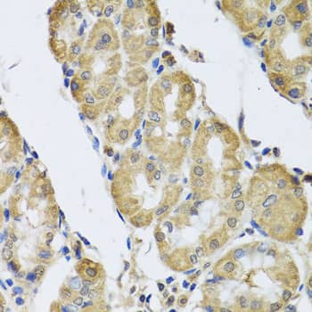 Immunohistochemistry: CaM Kinase II gamma Antibody [NBP3-37964] - Immunohistochemistry analysis of paraffin-embedded Human stomach using CaM Kinase II gamma Rabbit pAb at dilution of 1:100 (40x lens). Microwave antigen retrieval performed with 0.01M PBS Buffer (pH 7.2) prior to IHC staining.