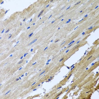 Immunohistochemistry: CaM Kinase II gamma Antibody [NBP3-37964] - Immunohistochemistry analysis of paraffin-embedded Rat heart using CaM Kinase II gamma Rabbit pAb at dilution of 1:100 (40x lens). Microwave antigen retrieval performed with 0.01M PBS Buffer (pH 7.2) prior to IHC staining.