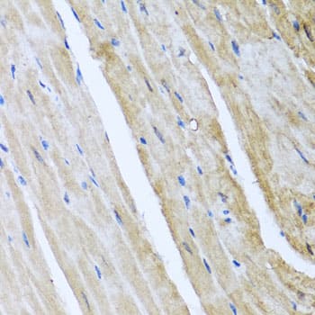 Immunohistochemistry: CaM Kinase II gamma Antibody [NBP3-37964] - Immunohistochemistry analysis of paraffin-embedded Mouse heart using CaM Kinase II gamma Rabbit pAb at dilution of 1:100 (40x lens). Microwave antigen retrieval performed with 0.01M PBS Buffer (pH 7.2) prior to IHC staining.