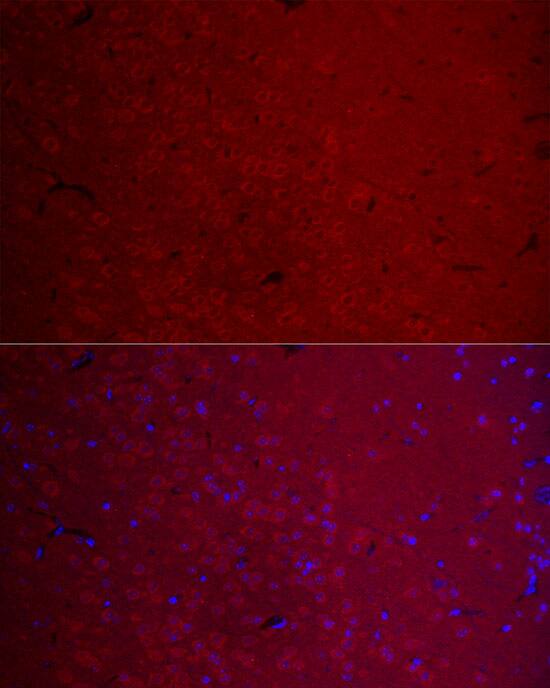 Immunocytochemistry/ Immunofluorescence: CaM Kinase II gamma Antibody [NBP3-37964] - Immunofluorescence analysis of paraffin-embedded Mouse brain using CaM Kinase II gamma Rabbit pAb at dilution of  1:100 (40x lens). Secondary antibody: Cy3 Goat Anti-Rabbit IgG (H+L) at 1:500 dilution. Blue: DAPI for nuclear staining.