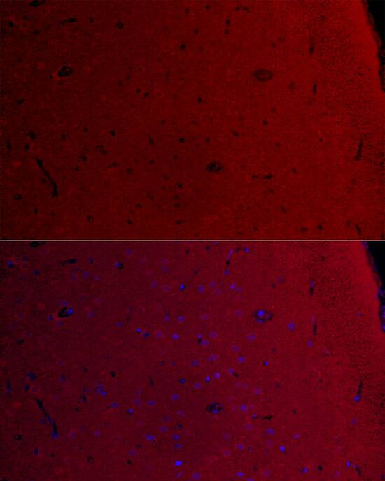 Immunocytochemistry/ Immunofluorescence: CaM Kinase II gamma Antibody [NBP3-37964] - Immunofluorescence analysis of paraffin-embedded Rat brain using CaM Kinase II gamma Rabbit pAb at dilution of  1:100 (40x lens). Secondary antibody: Cy3 Goat Anti-Rabbit IgG (H+L) at 1:500 dilution. Blue: DAPI for nuclear staining.