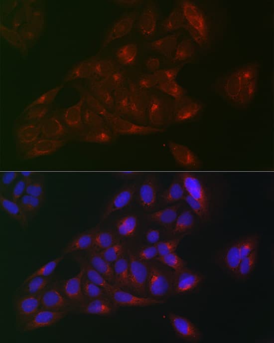 Immunocytochemistry/ Immunofluorescence RAB1B Antibody