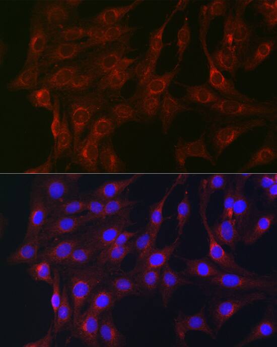 Immunocytochemistry/ Immunofluorescence RAB1B Antibody