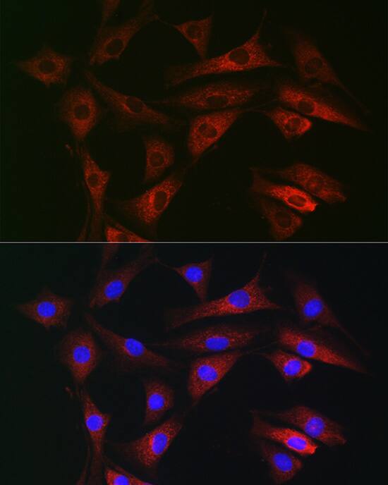 Immunocytochemistry/ Immunofluorescence RAB1B Antibody