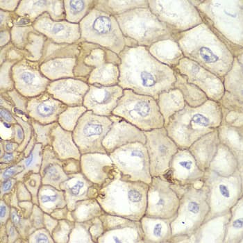 Immunohistochemistry: HLA A Antibody [NBP3-37966] - Immunohistochemistry analysis of paraffin-embedded Human esophagus using HLA A Rabbit pAb at dilution of 1:100 (40x lens). Microwave antigen retrieval performed with 0.01M PBS Buffer (pH 7.2) prior to IHC staining.