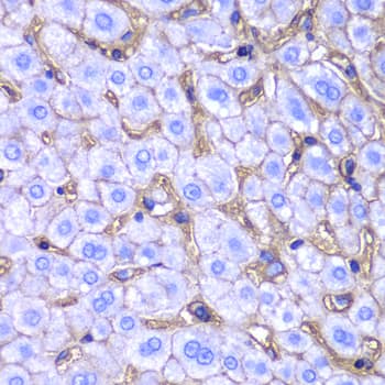 Immunohistochemistry: HLA A Antibody [NBP3-37966] - Immunohistochemistry analysis of paraffin-embedded Human liver damage using HLA A Rabbit pAb at dilution of 1:100 (40x lens). Microwave antigen retrieval performed with 0.01M PBS Buffer (pH 7.2) prior to IHC staining.