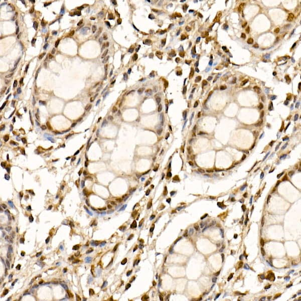 Immunohistochemistry Cullin 1 Antibody