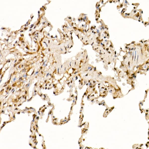 Immunohistochemistry: Cullin 1 Antibody [NBP3-37968] - Immunohistochemistry analysis of paraffin-embedded Rat lung using Cullin 1 Rabbit pAb at dilution of 1:50 (40x lens). High pressure antigen retrieval performed with 0.01M Citrate Bufferr (pH 6.0) prior to IHC staining.