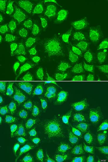 Immunocytochemistry/ Immunofluorescence: ATG4D Antibody [NBP3-37970] - Immunofluorescence analysis of U2OS cells using ATG4D Rabbit pAb at dilution of 1:100. Secondary antibody: Cy3-conjugated Goat anti-Rabbit IgG (H+L) at 1:500 dilution. Blue: DAPI for nuclear staining.