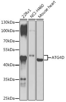 Western Blot: ATG4D Antibody [NBP3-37970] - Western blot analysis of various lysates using ATG4D Rabbit pAb at 1:1000 dilution.Secondary antibody: HRP-conjugated Goat anti-Rabbit IgG (H+L) at 1:10000 dilution.Lysates/proteins: 25ug per lane.Blocking buffer: 3% nonfat dry milk in TBST.Detection: ECL Basic Kit.Exposure time: 90s.