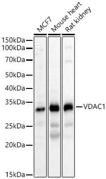 Western Blot: VDAC1 Antibody [NBP3-37975] - Western blot analysis of various lysates, using [KD Validated] VDAC1 Rabbit pAb at  1:500 dilution.Secondary antibody: HRP-conjugated Goat anti-Rabbit IgG (H+L) at 1:10000 dilution.Lysates/proteins: 25ug per lane.Blocking buffer: 3% nonfat dry milk in TBST.Detection: ECL Basic Kit.Exposure time: 10s.