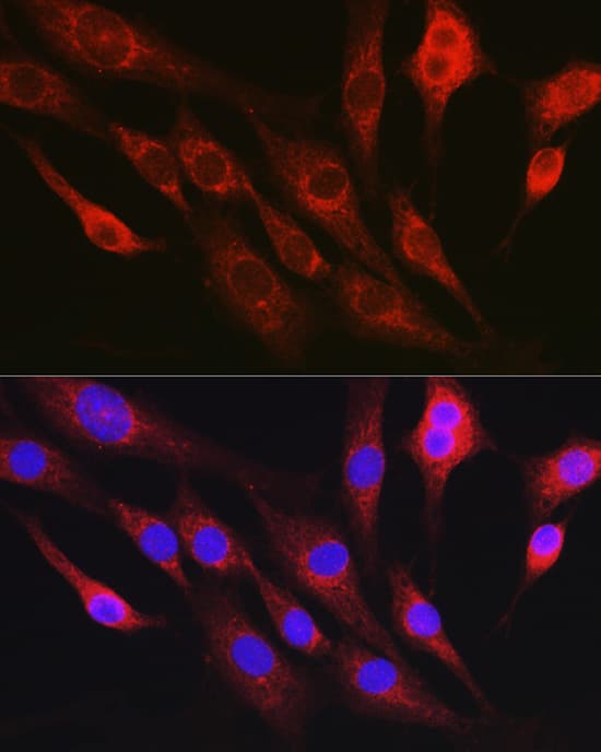 Western Blot: RhoC Antibody [NBP3-37976] - Western blot analysis of lysates from A549 cells using RhoC Rabbit pAb at 1:1000 dilution incubated overnight at 4C.Secondary antibody: HRP-conjugated Goat anti-Rabbit IgG (H+L) at 1:10000 dilution. Lysates/proteins: 25 ug per lane.Blocking buffer: 3% nonfat dry milk in TBST.Detection: ECL Basic KitExposure time: 90 s.