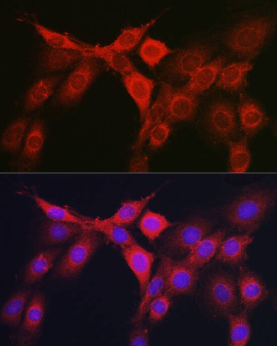 Immunocytochemistry/ Immunofluorescence: RhoC Antibody [NBP3-37976] - Immunofluorescence analysis of NIH/3T3 cells using RhoC Rabbit pAb at dilution of 1:100 (40x lens). Secondary antibody: Cy3-conjugated Goat anti-Rabbit IgG (H+L) at 1:500 dilution. Blue: DAPI for nuclear staining.