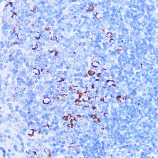 Immunohistochemistry: SHMT2 Antibody [NBP3-37977] - Immunohistochemistry analysis of paraffin-embedded Mouse spleen using SHMT2 Rabbit pAb at dilution of 1:100 (40x lens). Microwave antigen retrieval performed with 0.01M PBS Buffer (pH 7.2) prior to IHC staining.