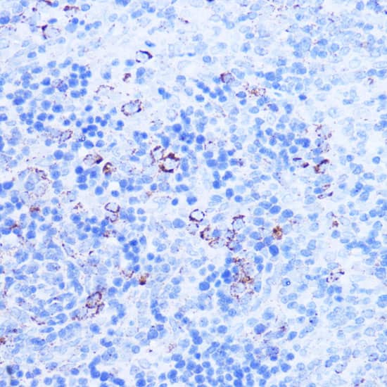 Immunohistochemistry: SHMT2 Antibody [NBP3-37977] - Immunohistochemistry analysis of paraffin-embedded Rat spleen using SHMT2 Rabbit pAb at dilution of 1:100 (40x lens). Microwave antigen retrieval performed with 0.01M PBS Buffer (pH 7.2) prior to IHC staining.