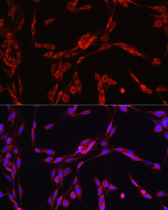 Immunocytochemistry/ Immunofluorescence: SEC61B Antibody [NBP3-37978] - Immunofluorescence analysis of PC-12 cells using SEC61B Rabbit pAb at dilution of 1:100 (40x lens). Secondary antibody: Cy3-conjugated Goat anti-Rabbit IgG (H+L) at 1:500 dilution. Blue: DAPI for nuclear staining.