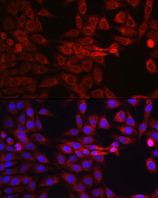 Immunocytochemistry/ Immunofluorescence: SEC61B Antibody [NBP3-37978] - Immunofluorescence analysis of NIH/3T3 cells using SEC61B Rabbit pAb at dilution of 1:100 (40x lens). Secondary antibody: Cy3-conjugated Goat anti-Rabbit IgG (H+L) at 1:500 dilution. Blue: DAPI for nuclear staining.