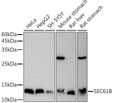 Western Blot: SEC61B Antibody [NBP3-37978] - Western blot analysis of various lysates using SEC61B Rabbit pAb at 1:1000 dilution.Secondary antibody: HRP-conjugated Goat anti-Rabbit IgG (H+L) at 1:10000 dilution.Lysates/proteins: 25ug per lane.Blocking buffer: 3% nonfat dry milk in TBST.Detection: ECL Basic Kit.Exposure time: 3s.