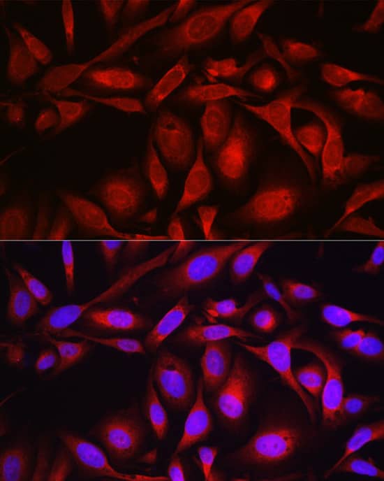 Immunocytochemistry/ Immunofluorescence: SEC61B Antibody [NBP3-37978] - Immunofluorescence analysis of U2OS cells using SEC61B Rabbit pAb at dilution of 1:100 (40x lens). Secondary antibody: Cy3-conjugated Goat anti-Rabbit IgG (H+L) at 1:500 dilution. Blue: DAPI for nuclear staining.