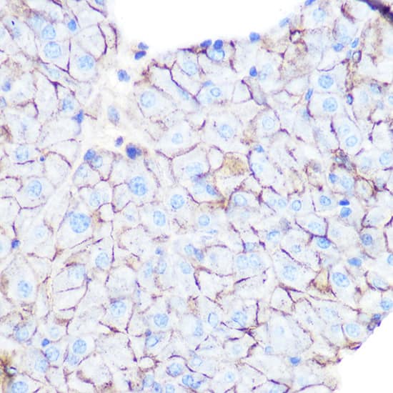 Immunohistochemistry: Flotillin-1 Antibody [NBP3-37979] - Immunohistochemistry analysis of paraffin-embedded Mouse pancreas using Flotillin-1 Rabbit pAb at dilution of 1:100 (40x lens). Microwave antigen retrieval performed with 0.01M Tris/EDTA Buffer (pH 9.0) prior to IHC staining.