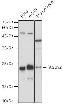 Western Blot: transgelin 2 Antibody [NBP3-37980] - Western blot analysis of various lysates using transgelin 2 Rabbit pAb at 1:1000 dilution.Secondary antibody: HRP-conjugated Goat anti-Rabbit IgG (H+L) at 1:10000 dilution.Lysates/proteins: 25ug per lane.Blocking buffer: 3% nonfat dry milk in TBST.Detection: ECL Basic Kit.Exposure time: 60s.