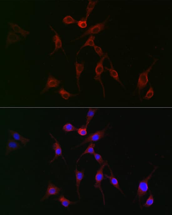 Immunocytochemistry/ Immunofluorescence: transgelin 2 Antibody [NBP3-37980] - Immunofluorescence analysis of BALB-3T3 cells using transgelin 2 Rabbit pAb at dilution of 1:100 (40x lens). Secondary antibody: Cy3-conjugated Goat anti-Rabbit IgG (H+L) at 1:500 dilution. Blue: DAPI for nuclear staining.