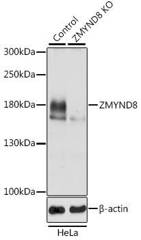 <b>Genetic Strategies Validation. </b>Western Blot: PRKCBP1 Antibody [NBP3-37981] - Western Blot analysis of lysates from wild type (WT) and PRKCBP1 knockout (KO) HeLa cells, using [KO Validated] PRKCBP1 Rabbit pAb at 1:3000 dilution.Secondary antibody: HRP Goat Anti-Rabbit IgG (H+L) at 1:10000 dilution.Lysates/proteins: 25ug per lane.Blocking buffer: 3% nonfat dry milk in TBST.Detection: ECL Basic Kit.Exposure time: 1s.