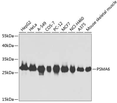 Western Blot: Proteasome 20S alpha 6 Antibody [NBP3-37982] - Western blot analysis of various lysates using Proteasome 20S alpha 6 Rabbit pAb at 1:1000 dilution.Secondary antibody: HRP-conjugated Goat anti-Rabbit IgG (H+L) at 1:10000 dilution.Lysates/proteins: 25ug per lane.Blocking buffer: 3% nonfat dry milk in TBST.