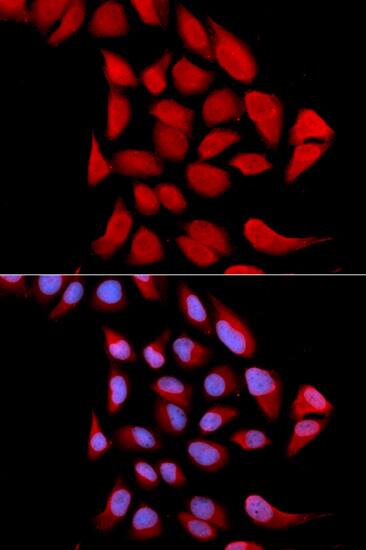 Immunocytochemistry/ Immunofluorescence: Proteasome 20S alpha 6 Antibody [NBP3-37982] - Immunofluorescence analysis of U2OS cells using Proteasome 20S alpha 6 Rabbit pAb. Secondary antibody: Cy3-conjugated Goat anti-Rabbit IgG (H+L) at 1:500 dilution. Blue: DAPI for nuclear staining.